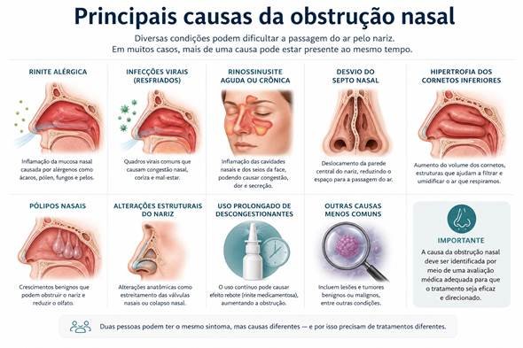 Infográfico mostrando as principais causas da obstrução nasal, incluindo rinite, alterações anatômicas e outras condições