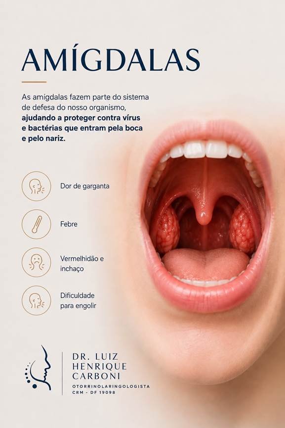 Ilustração das amígdalas palatinas aumentadas na garganta