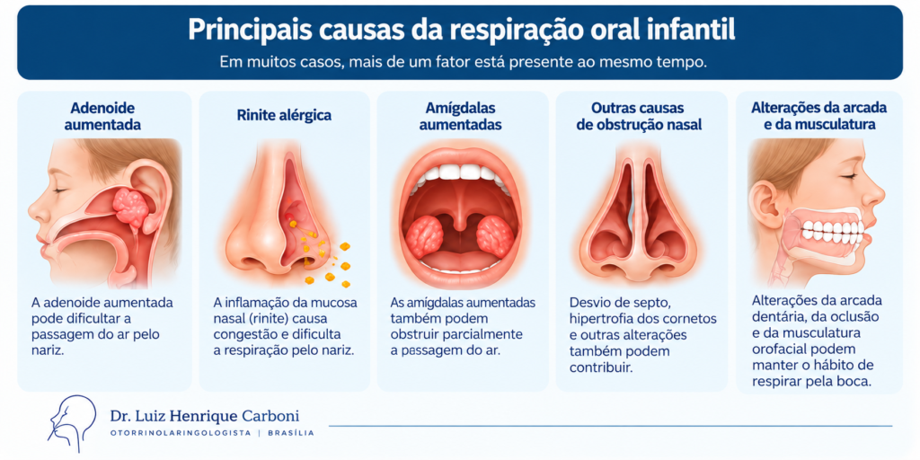Principais causas da respiração oral infantil: adenoide, rinite, amígdalas e outras obstruções nasais