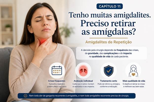Amigdalites de repetição e indicação de retirada das amígdalas
