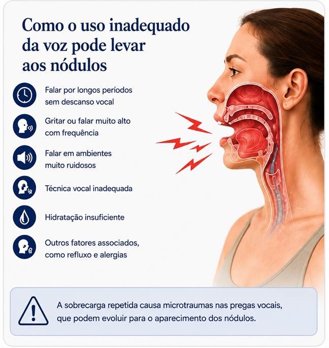 Como o uso inadequado da voz pode favorecer nódulos nas pregas vocais