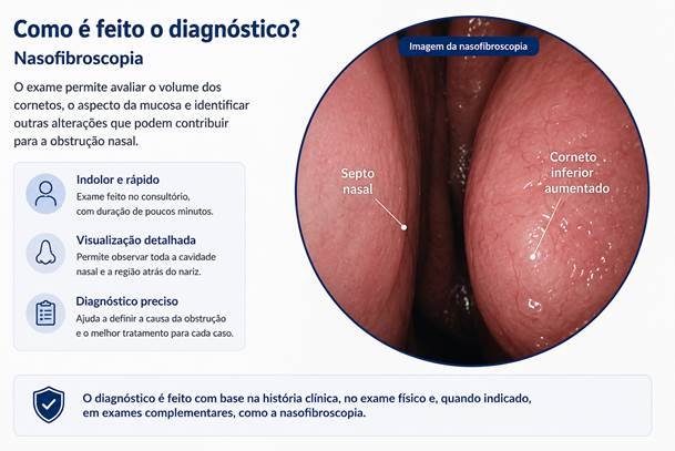 Imagem de nasofibroscopia mostrando o septo nasal e o corneto inferior aumentado.
