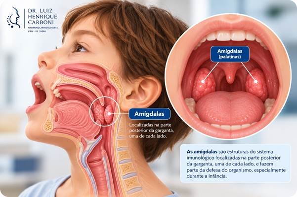 Amígdalas na criança: localização das amígdalas palatinas na parte posterior da garganta.
