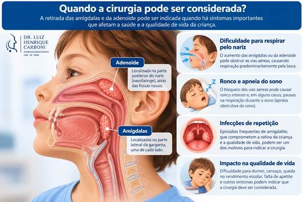 Cirurgia de amígdalas e adenoide em crianças: quando pode ser indicada