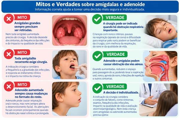 Mitos e Verdades sobre a cirurgia das amígdalas e da adenoide na infância.